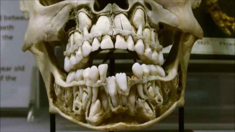 10b Skull With Double Set Of Teeth